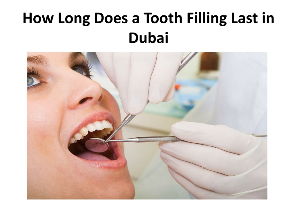 PPT How Long Does A Tooth Filling Last In Dubai PowerPoint