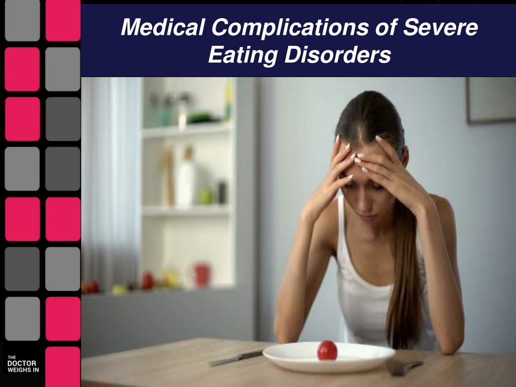 Ppt Medical Management Of Severe Eating Disorders Powerpoint Presentation Id