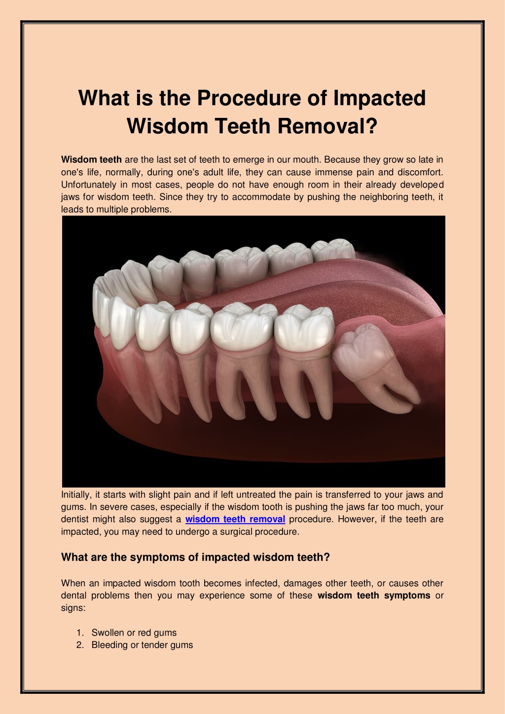 Ppt What Is The Procedure Of Impacted Wisdom Teeth Removal Pdf