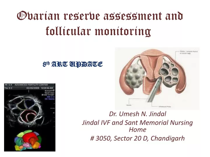 Ppt Ovarian Reserve Testing And Follicular Monitoring By Dr Umesh N