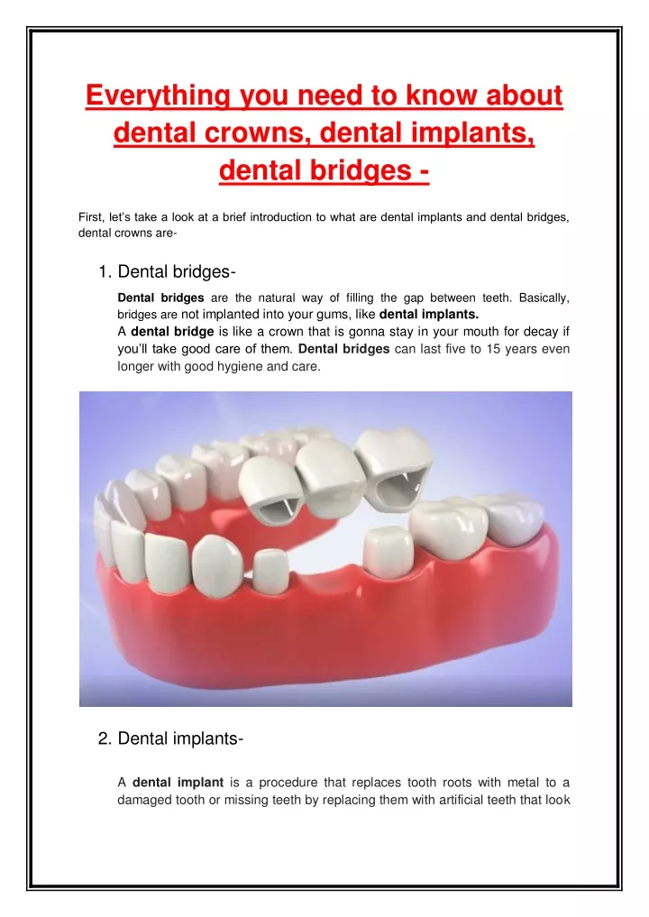 Ppt Everything You Need To Know About Dental Crowns Dental Implants