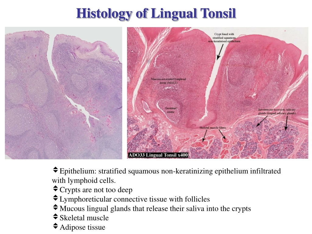 PPT Lymphatic Organs Thymus Tonsils And MALT PowerPoint Presentation