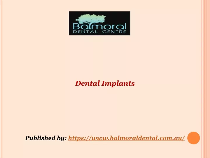 dental implants published by https n.