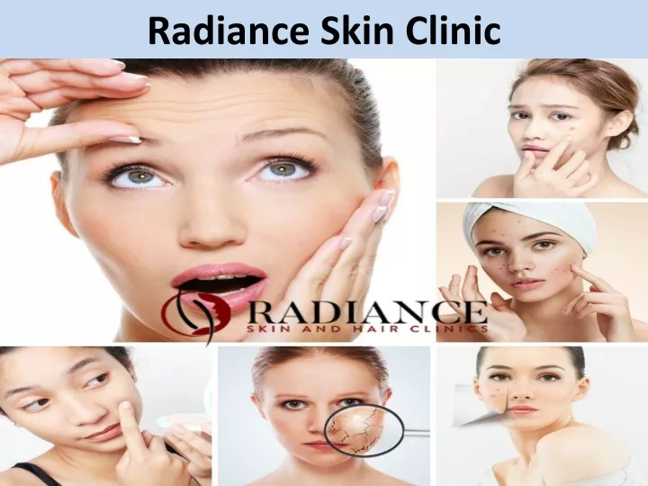 radiance skin clinic n.