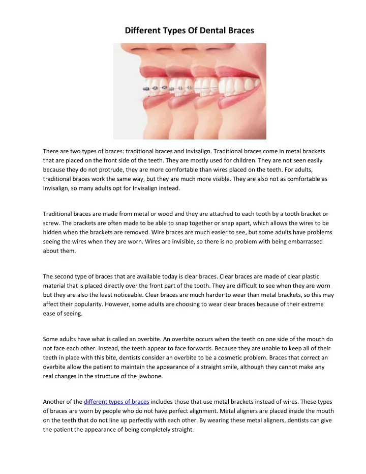 different types of dental braces n.