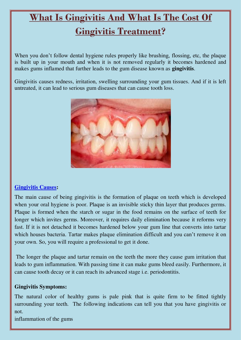 PPT - What Is Gingivitis And What Is The Cost Of Gingivitis Treatment ...