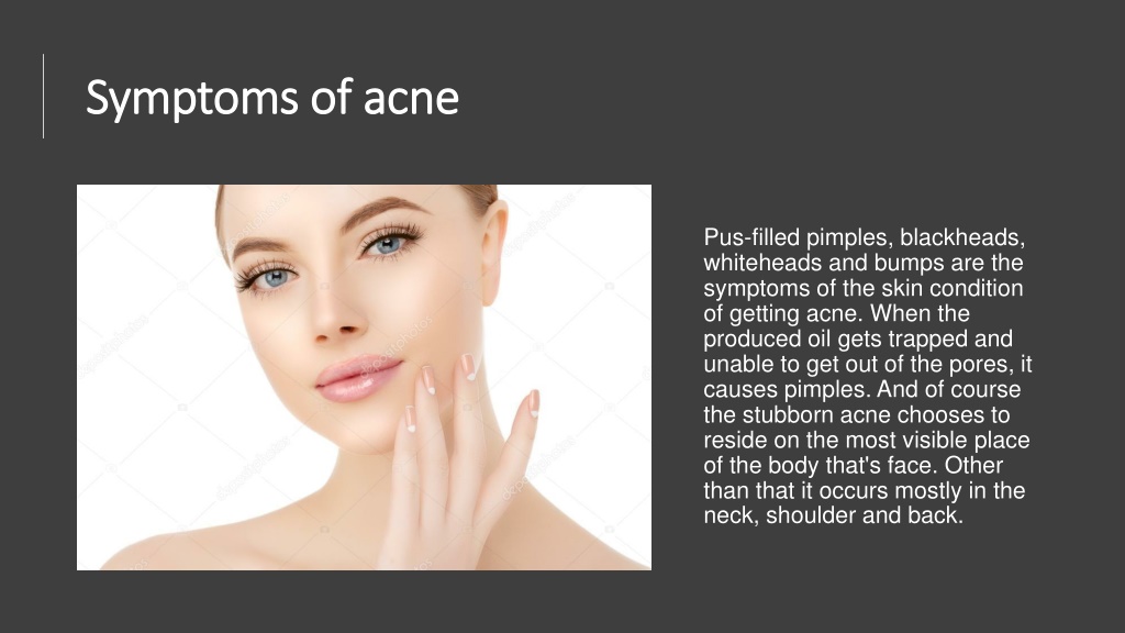 PPT - Now say goodbye to acne, blemishes and pimples PowerPoint ...