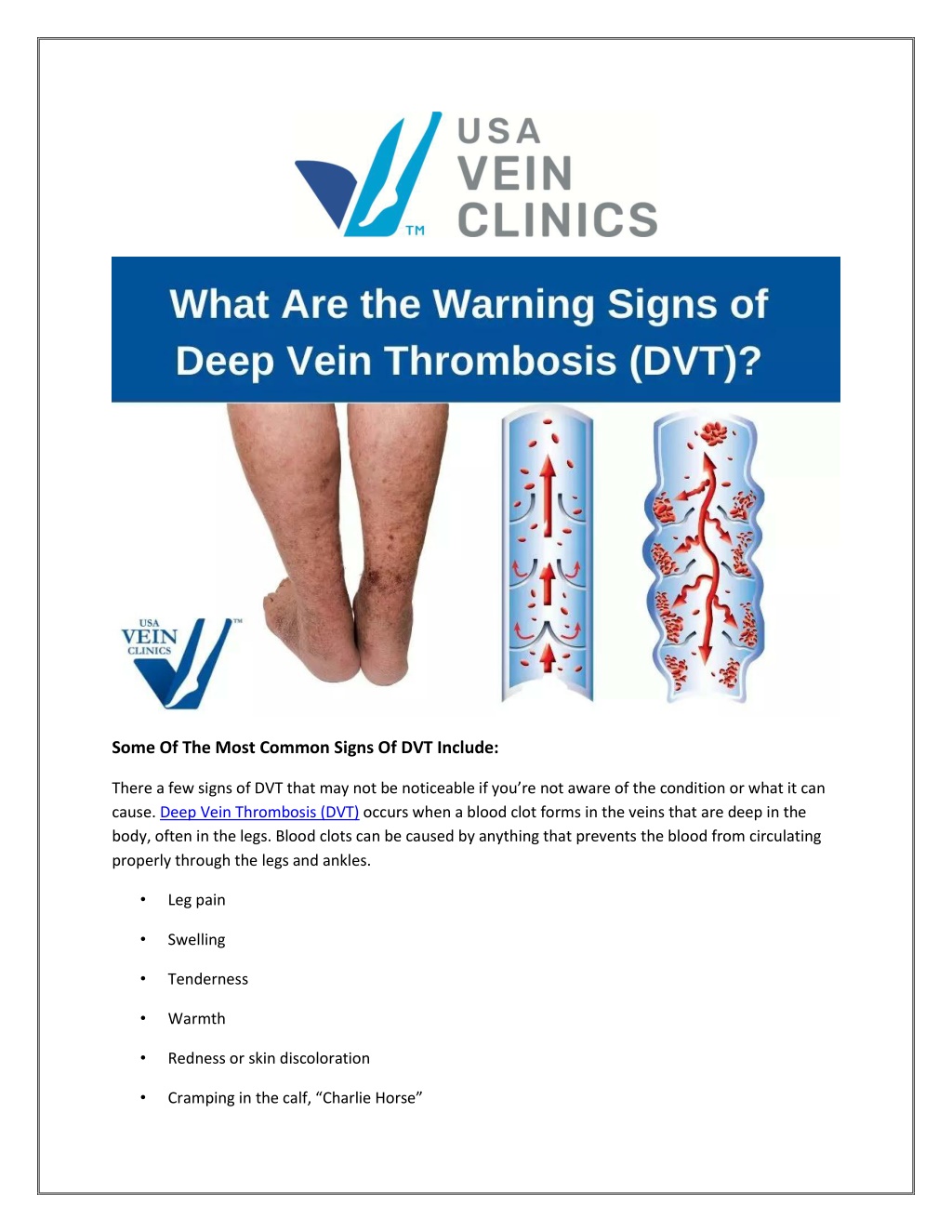 PPT - What Are the Warning Signs of Deep Vein Thrombosis (DVT ...