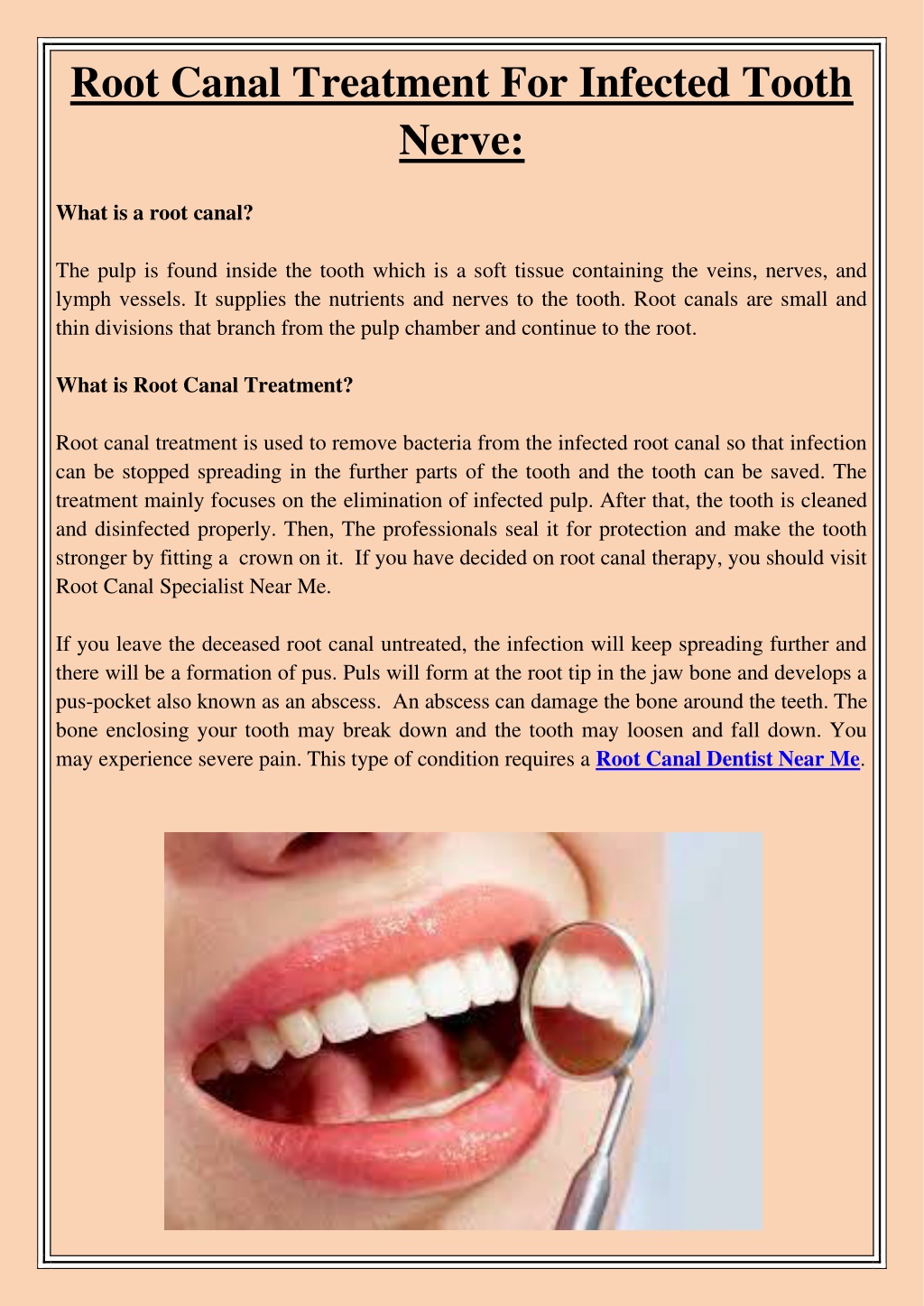 PPT - Root Canal Treatment For Infected Tooth Nerve PowerPoint ...