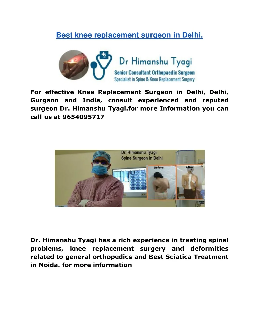 PPT - Best knee replacement surgeon in Delhi PowerPoint Presentation ...