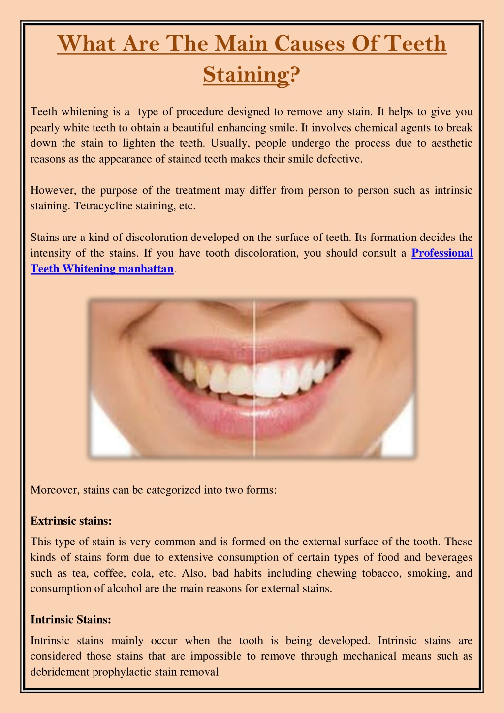 PPT - What Are The Main Causes Of Teeth Staining PowerPoint ...