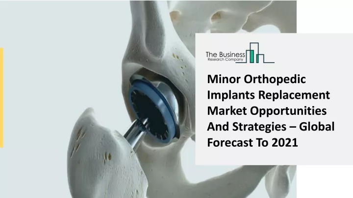 PPT - Minor Orthopedic Implants Replacement Market New Innovations And ...