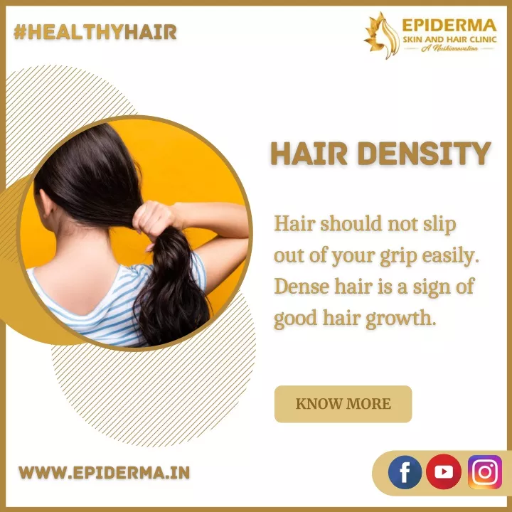 Ppt Hair Density Best Dermatology Centres In Jayanagar Bangalore Epiderma Clinic 4362