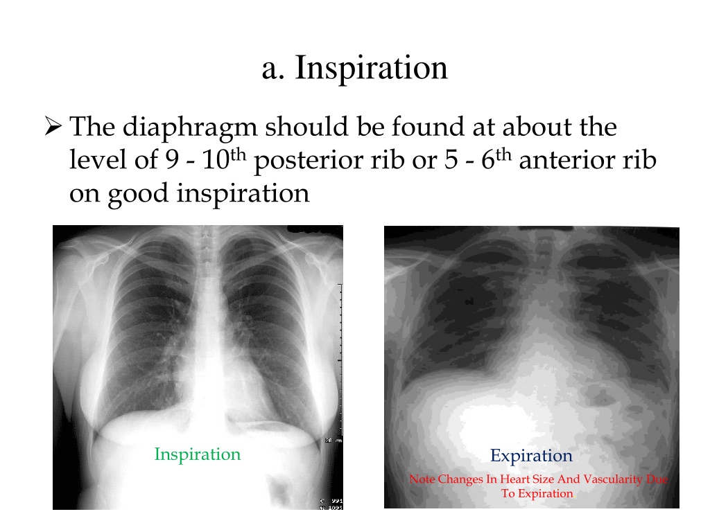 x ray presentation pdf