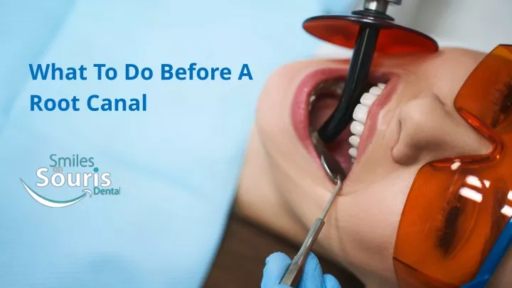 ppt-what-to-do-before-a-root-canal-powerpoint-presentation-free