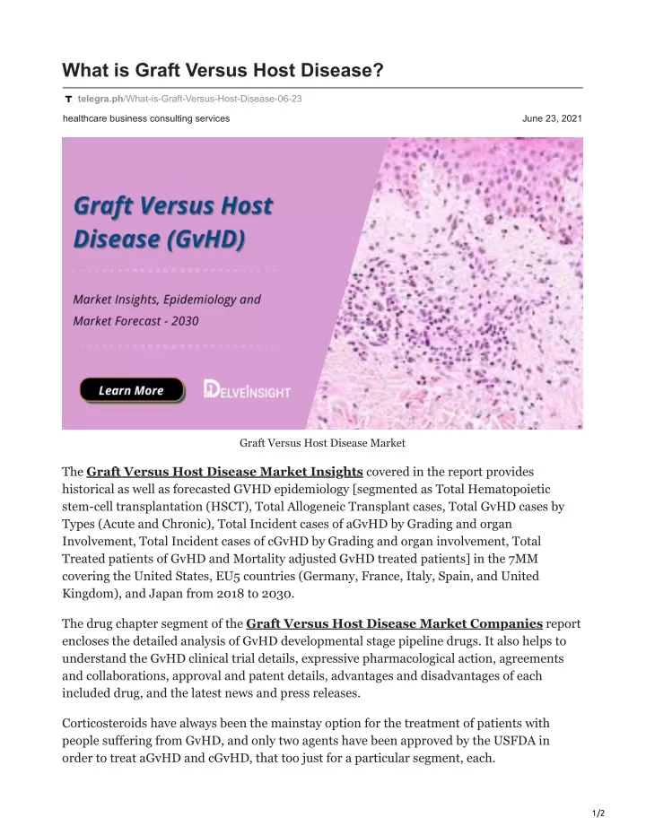 PPT - Graft Versus Host Disease PowerPoint Presentation, Free Download ...