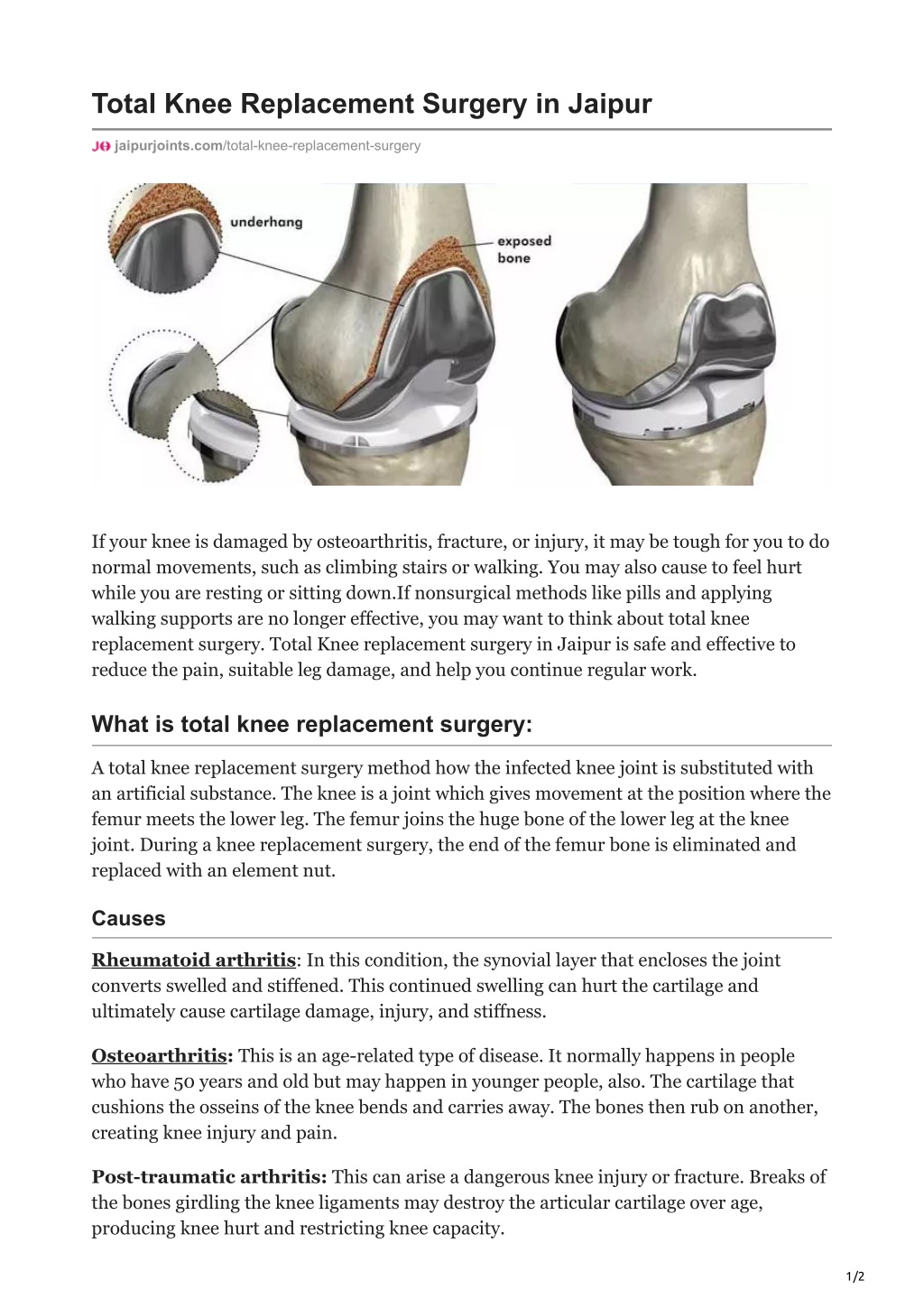 PPT - Knee Replacement Surgery in Jaipur Jaipurjoints PowerPoint ...