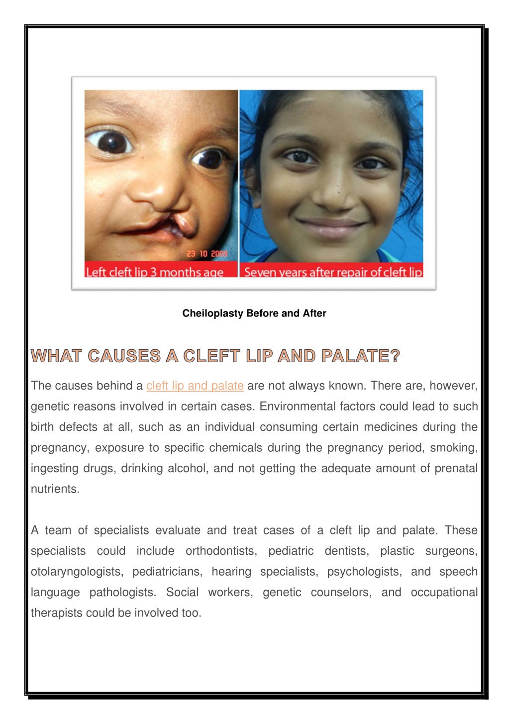 PPT - The Case of a Cleft Lip and Palate Surgery | Richardson Hospital ...