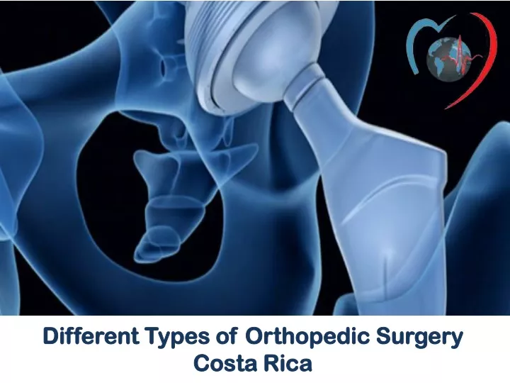 PPT - Different Types Of Orthopedic Surgery Costa Rica PowerPoint ...