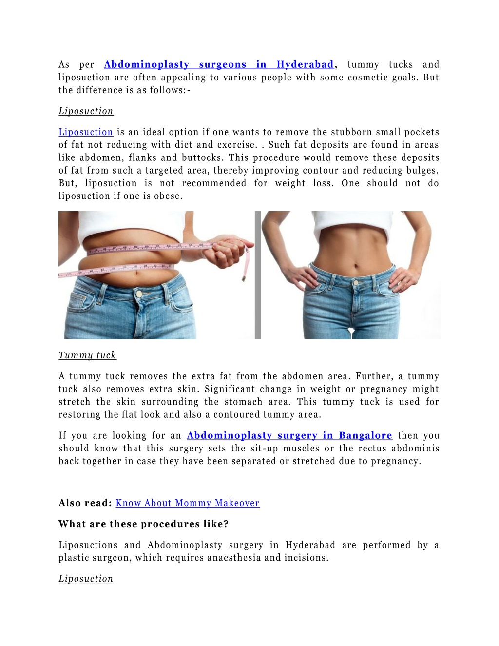 Ppt Abdominoplasty Surgery In Hyderabad Or Tummy Tuck Which Is Better Powerpoint Presentation