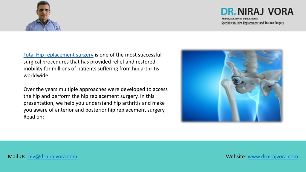 Ppt Anterior Hip Replacement Vs Posterior Hip Replacement Dr Niraj Vora Powerpoint 