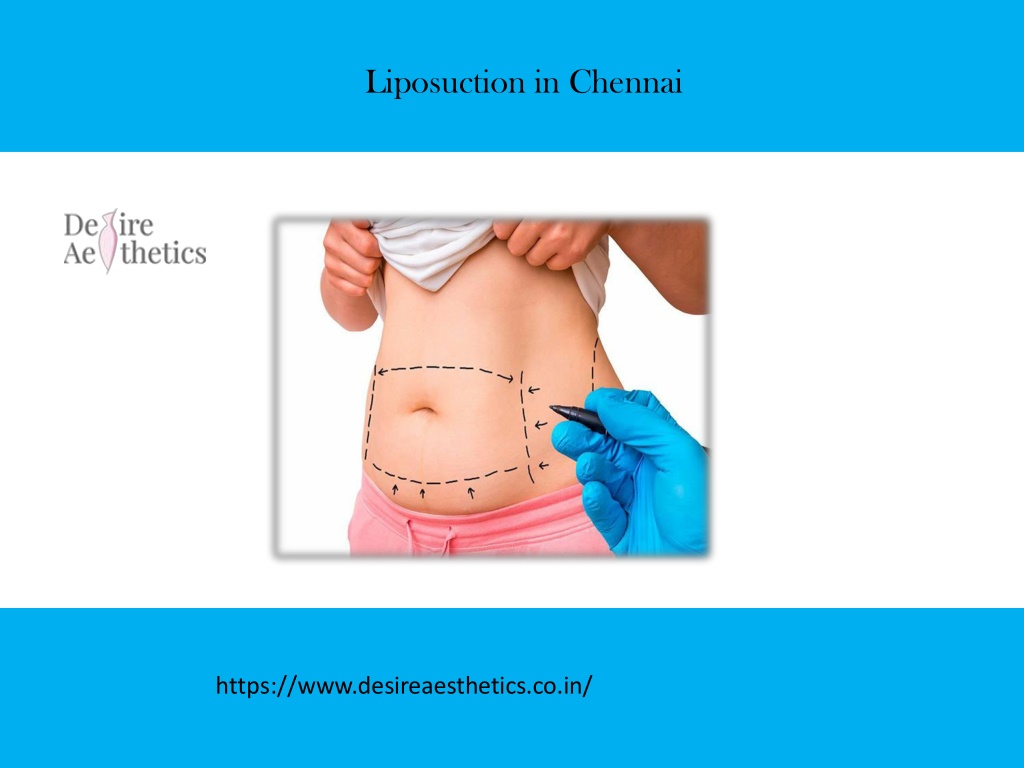 Liposuction Cost In Chennai