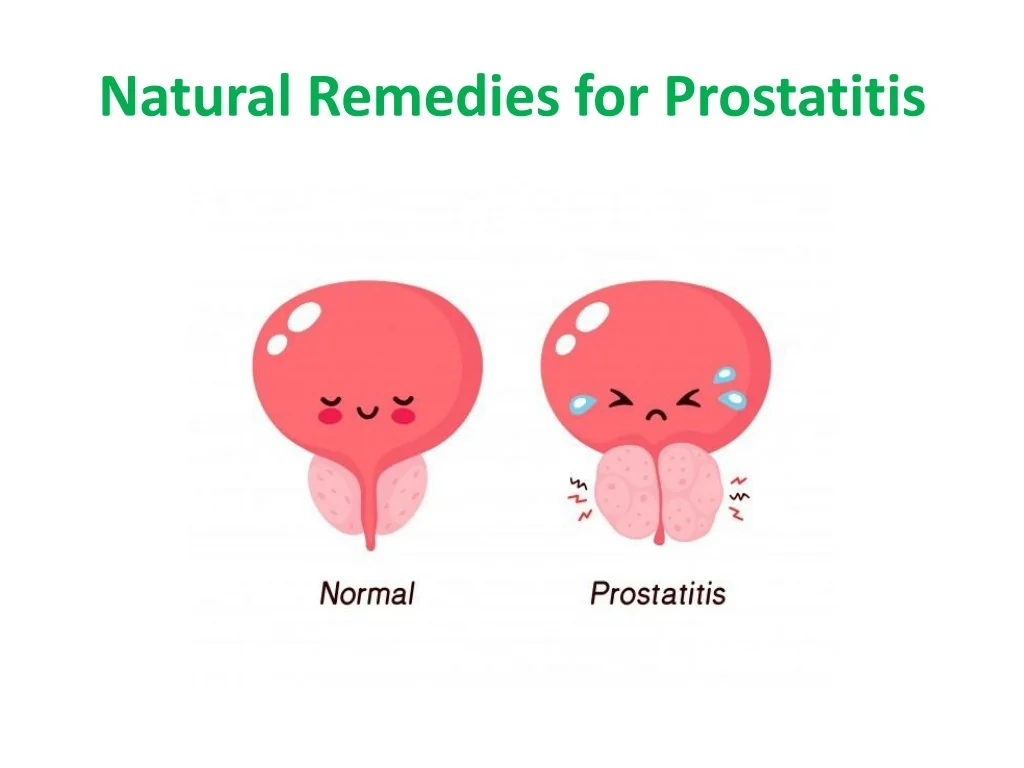 PPT How to Treat Sciatica in Ayurveda through Herbal Medicine — free download