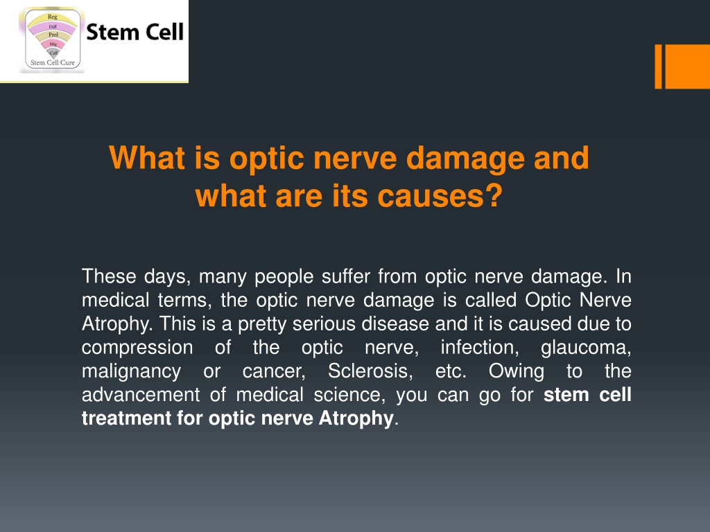 ppt-stem-cell-treatment-for-optic-nerve-damage-powerpoint