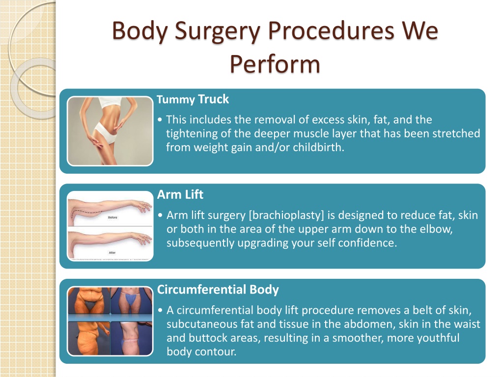 PPT Body Surgery in Richmond Richmond Surgical Arts PowerPoint