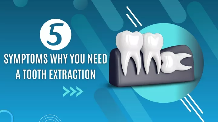PPT - 5 Symptoms Why You Need a Tooth Extraction PowerPoint