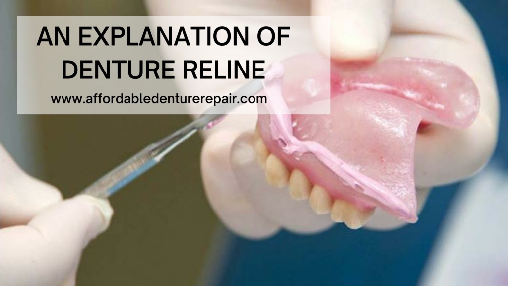 PPT Denture Reline PowerPoint Presentation, free download ID10744601