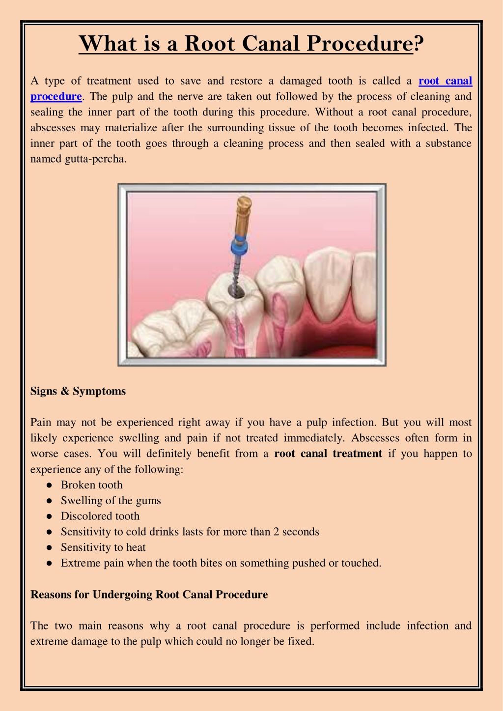 PPT What is a Root Canal Procedure PowerPoint Presentation, free