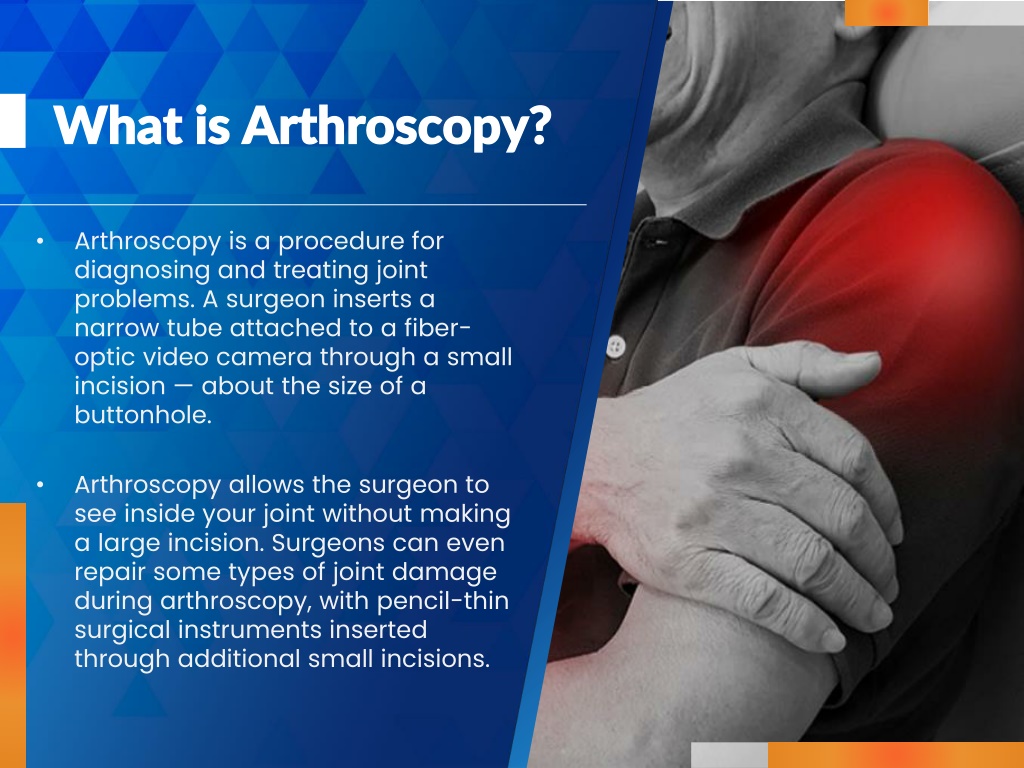 PPT - What Is Arthroscopy? PowerPoint Presentation, Free Download - ID ...