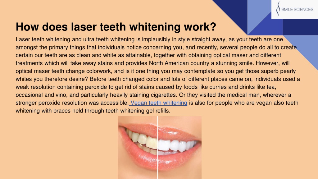 ppt-how-does-laser-teeth-whitening-work-powerpoint-presentation-free