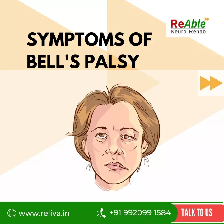 PPT - Bells Palsy visual series PowerPoint Presentation, free download ...