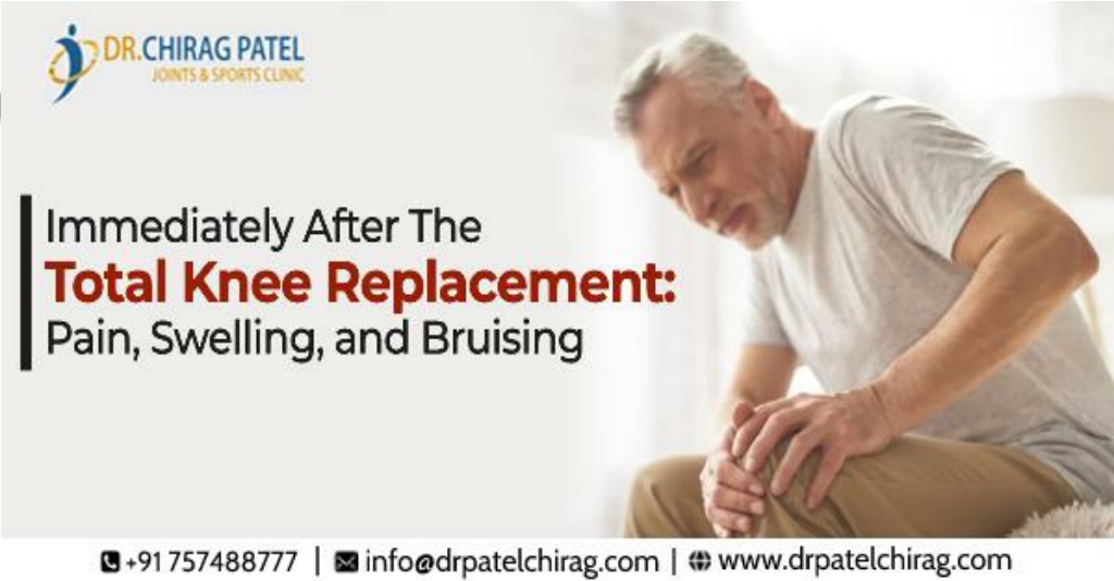 Ppt Immediately After The Total Knee Replacement Pain Swelling And