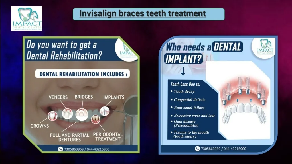 PPT Invisalign braces teeth treatment in chennai PowerPoint