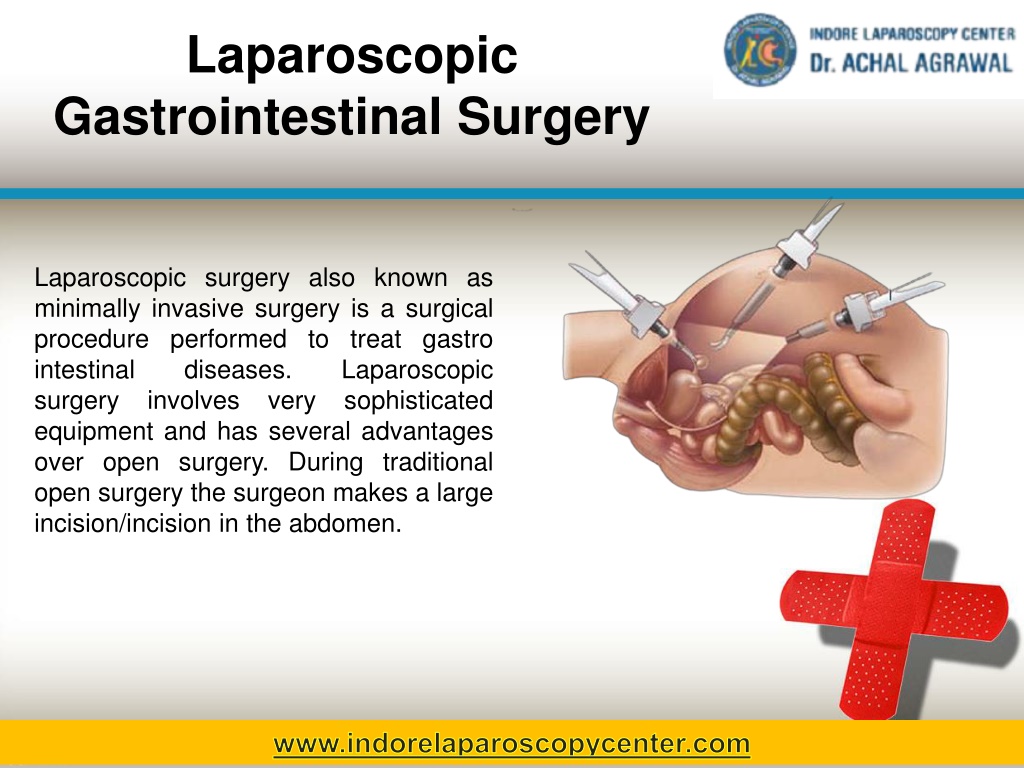 laparoscopic-gastrointestinal-surgery-l.jpg