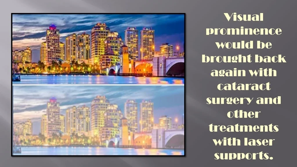 Visual Prominence Examples PPT - The Best Ophthalmologists Can Treat All Eye Ailments Perfectly ...