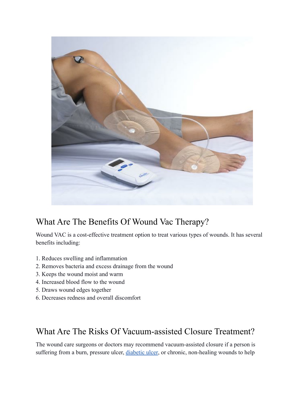 PPT Everything You Need To Know About Wound Vac Negative Pressure Wound Therapy PowerPoint