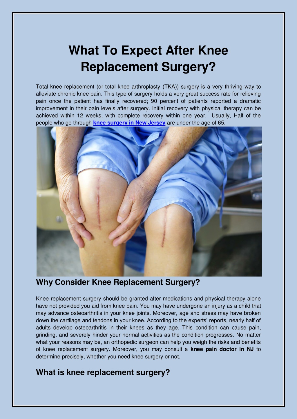Ppt What To Expect After Knee Replacement Surgery Powerpoint Presentation Id10877071 4426