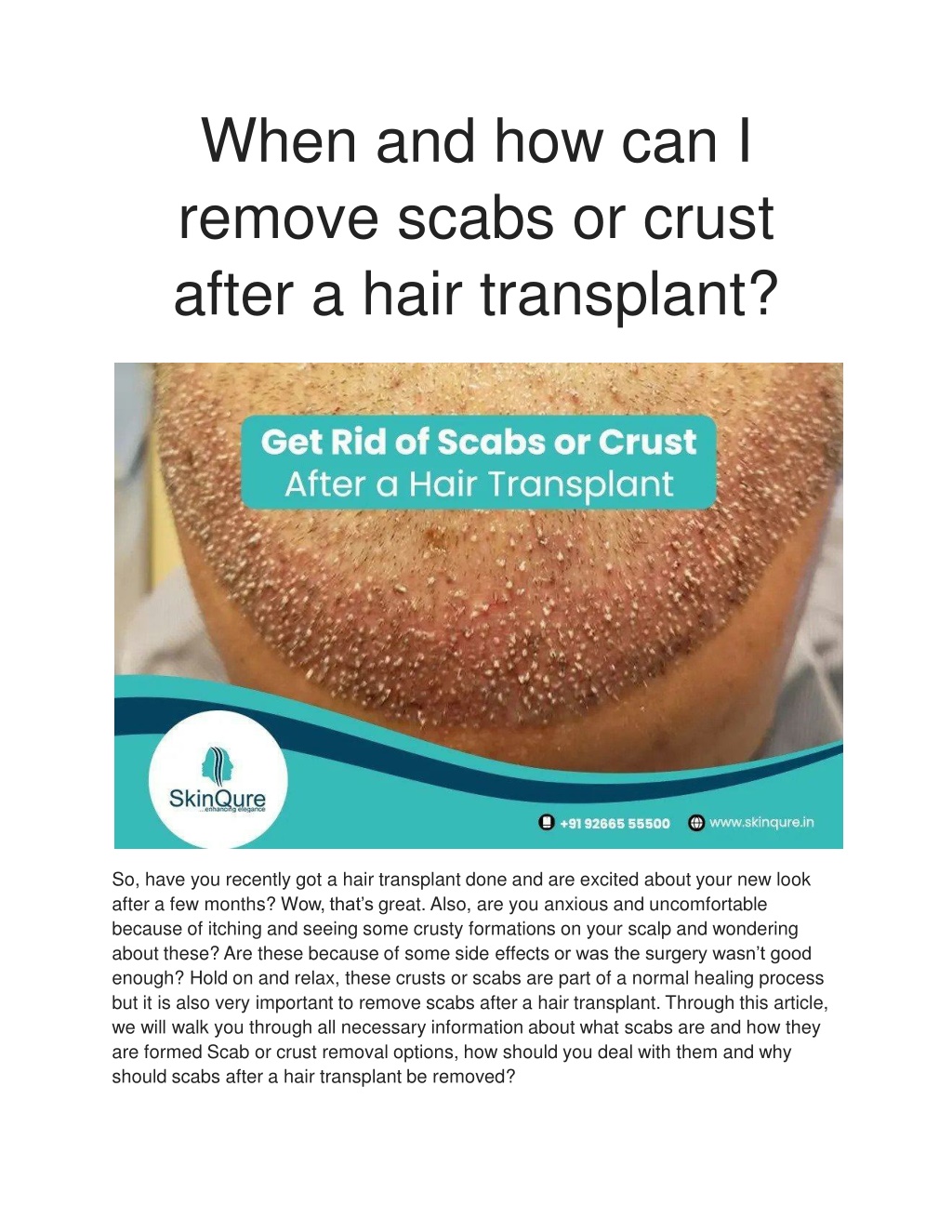 PPT - When and how can I remove scabs or crust after a hair transplant ...