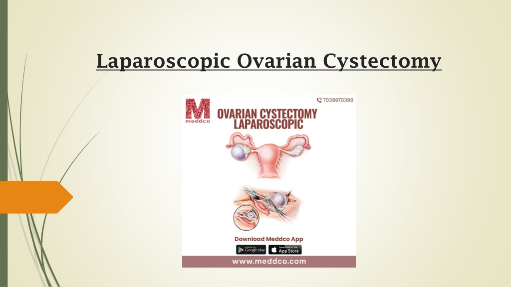 PPT Laparoscopic Ovarian Cystectomy Meddco PowerPoint Presentation