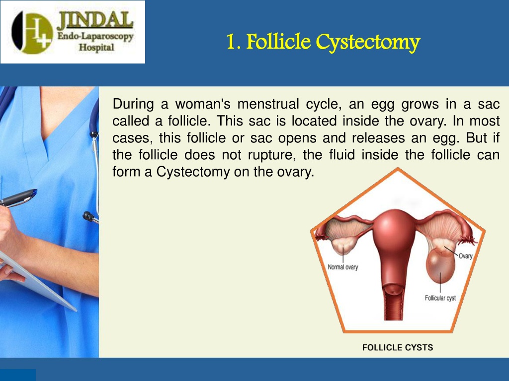 Ppt Ovarian Cystectomy Specialist In Kota Visit Jindal Hospital Powerpoint Presentation Id