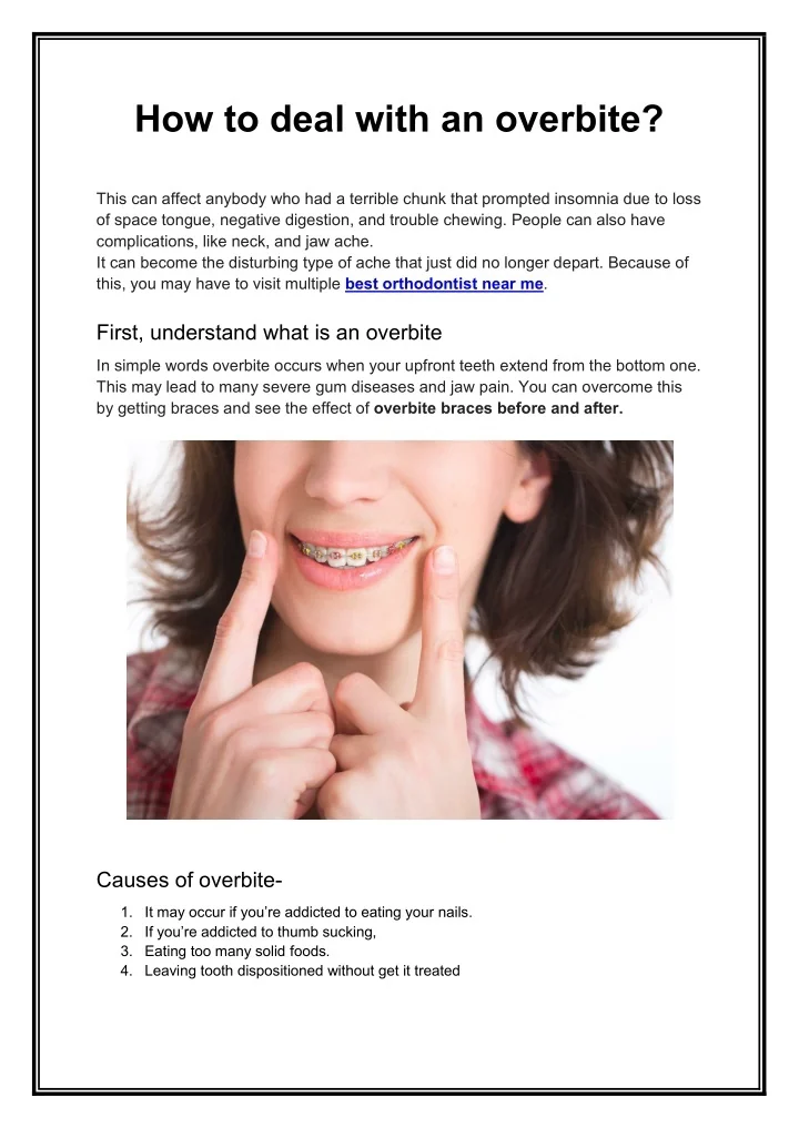 PPT - How to deal with an overbite PowerPoint Presentation, free ...