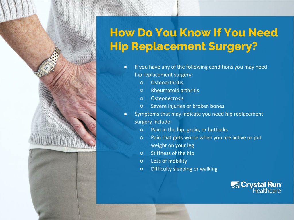 PPT Everything You Need To Know About Hip Replacements PowerPoint