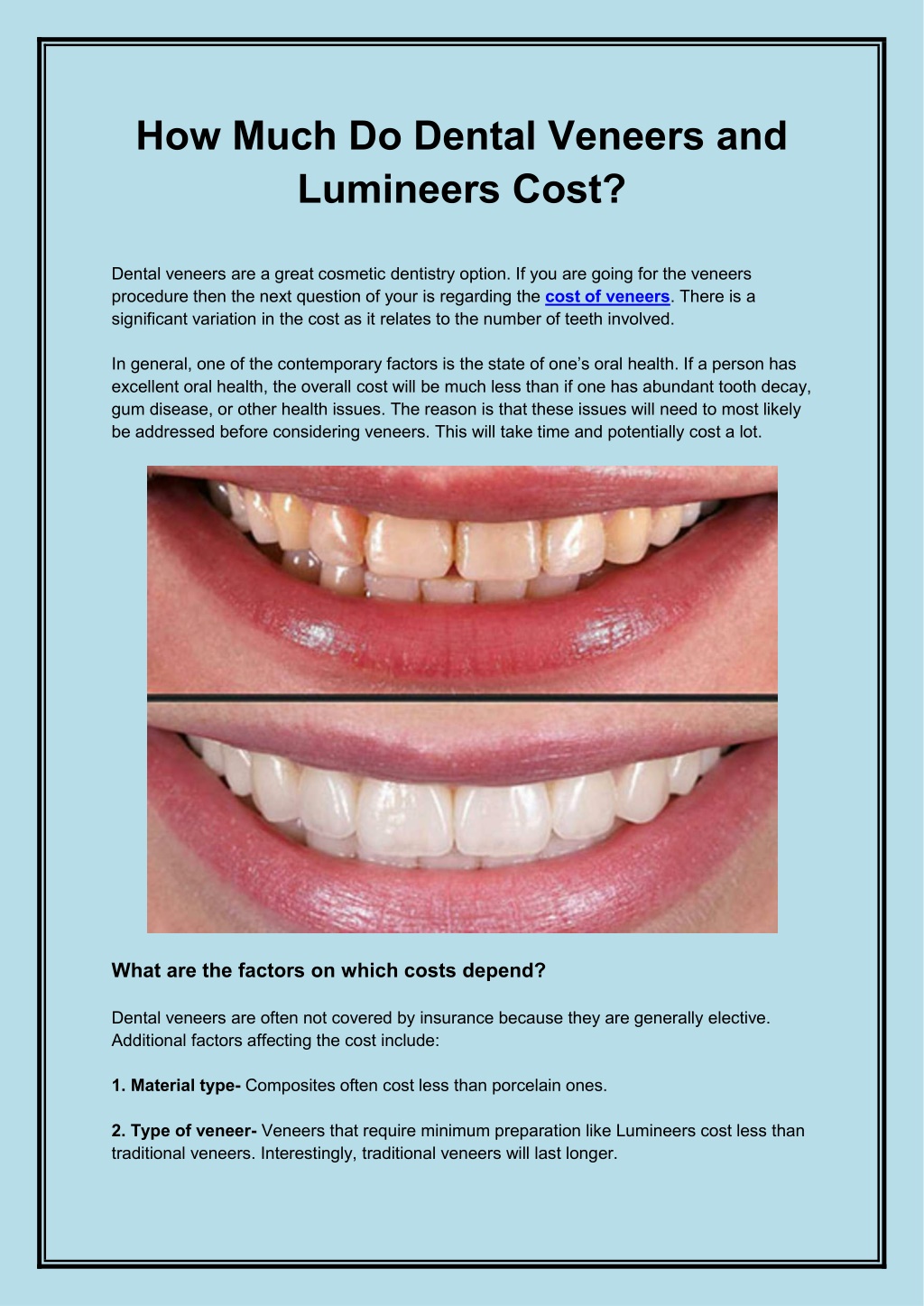 PPT How Much Do Dental Veneers and Lumineers Cost PowerPoint