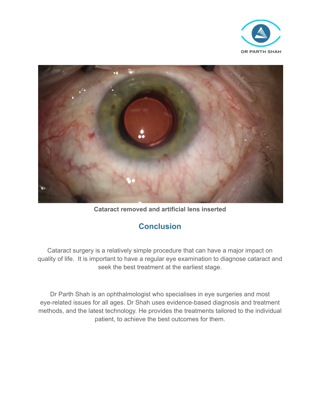 Ppt Traditional Cataract Surgery Vs Laser Assisted Cataract Surgery Powerpoint Presentation 7555