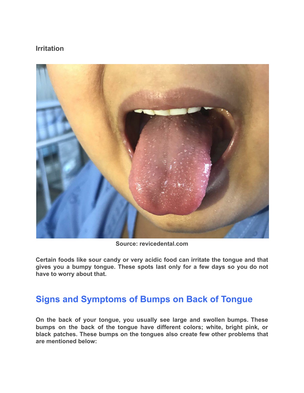 PPT - Know About Bumps On Back Of Tongue PowerPoint Presentation, free ...