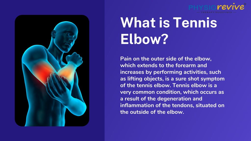 PPT - Physiorevive-Tennis Elbow and Physiotherapy PowerPoint ...